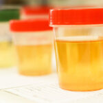 Badania profilaktyczne - łatwa diagnostyka z dużą mocą